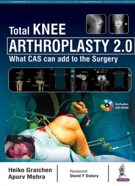 Book cover of: Total Knee Arthroplasty 2.0. By: Heiko Graichen