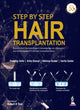 Book cover of: Step by Step Hair Transplantation. By: Pradeep Sethi