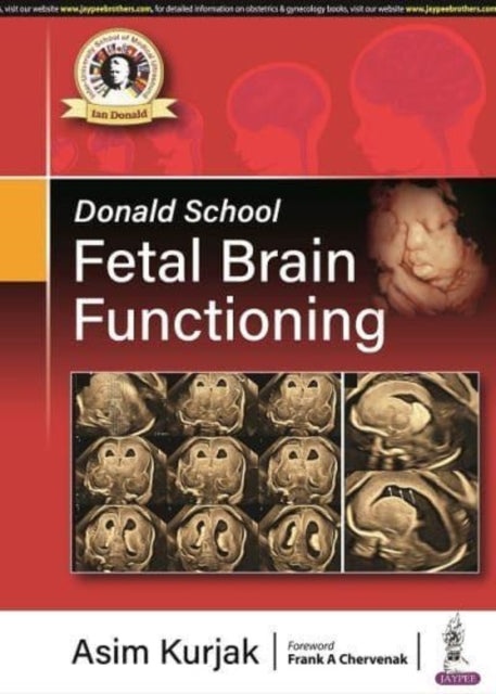 Book cover of: Donald School Fetal Brain Functioning. By: Asim Kurjak
