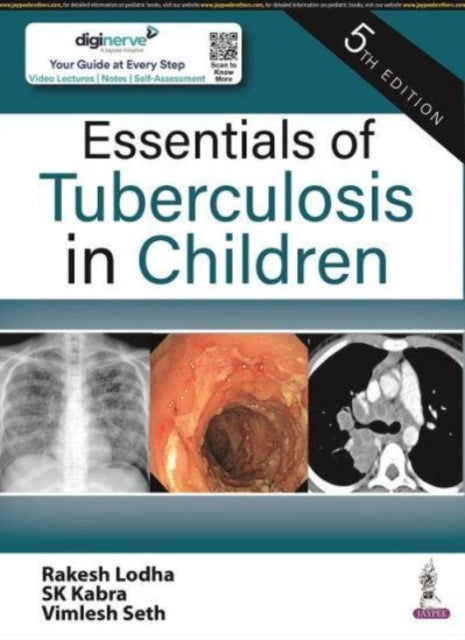 Book cover of: Essentials of Tuberculosis in Children. By: Rakesh Lodha