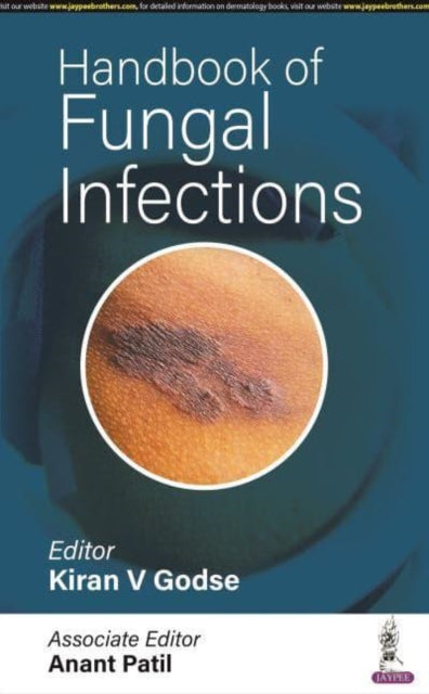 Book cover of: Handbook of Fungal Infections. By: Kiran V. Godse