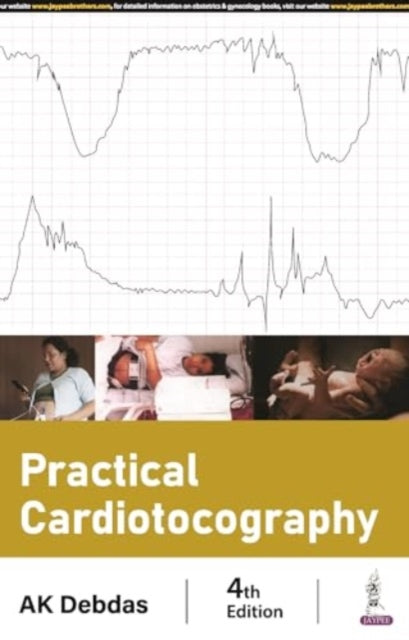 Book cover of: Practical Cardiotocography. By: DEBDAS