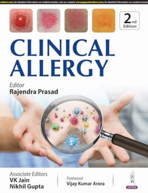 Clinical Allergy