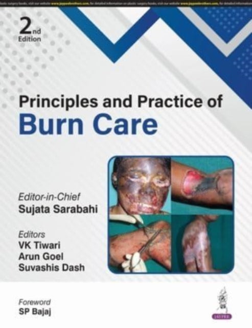 Book cover of: Principles and Practice of Burn Care