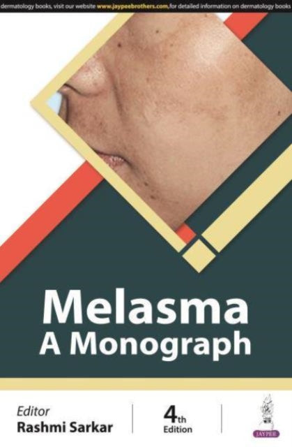 Book cover of: Melasma