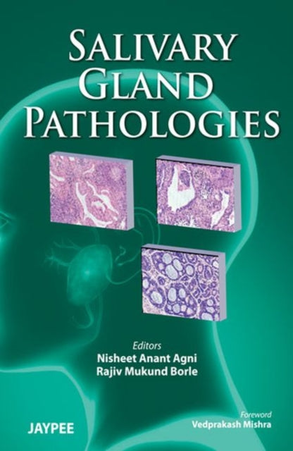 Book cover of: Salivary Gland Pathologies. By: Nisheet Anant Agni