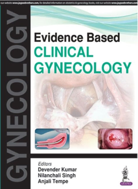 Book cover of: Evidence Based Clinical Gynecology. By: Devender Kumar