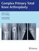 Book cover of: Complex Primary Total Knee Arthroplasty