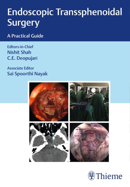 Book cover of: Endoscopic Transsphenoidal Surgery