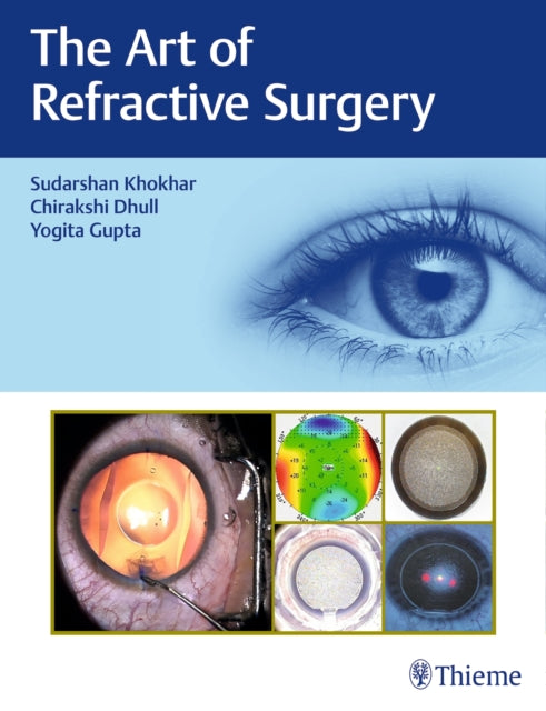 Book cover of: Art of Refractive Surgery. By: Sudharshan Khokhar