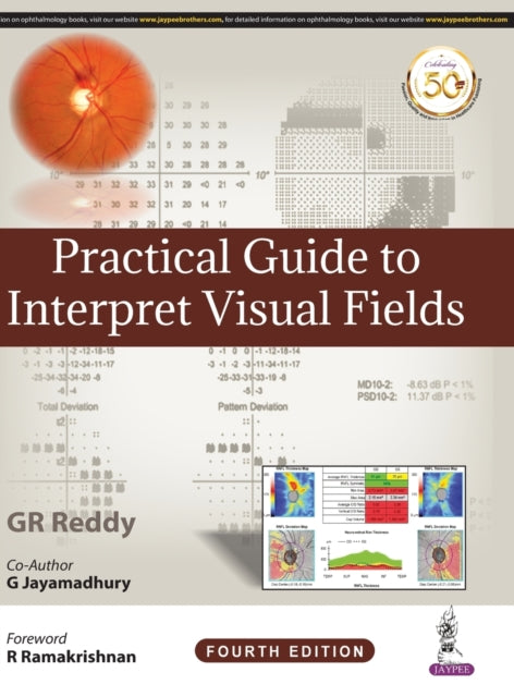 Practical Guide to Interpret Visual Fields