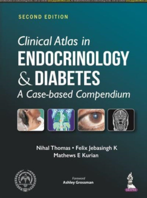 Book cover of: Clinical Atlas in Endocrinology and Diabetes. By: Nihal Thomas