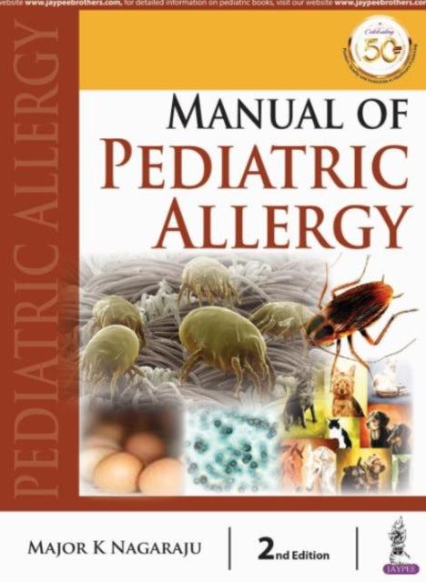 Book cover of: Manual of Pediatric Allergy. By: NAGARAJU