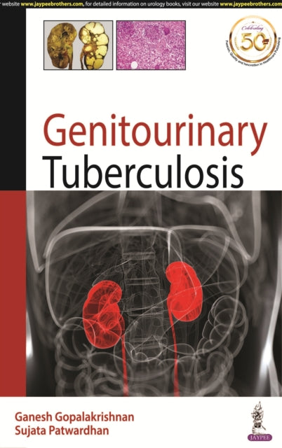 Book cover of: Genitourinary Tuberculosis. By: Ganesh Gopalakrishnan