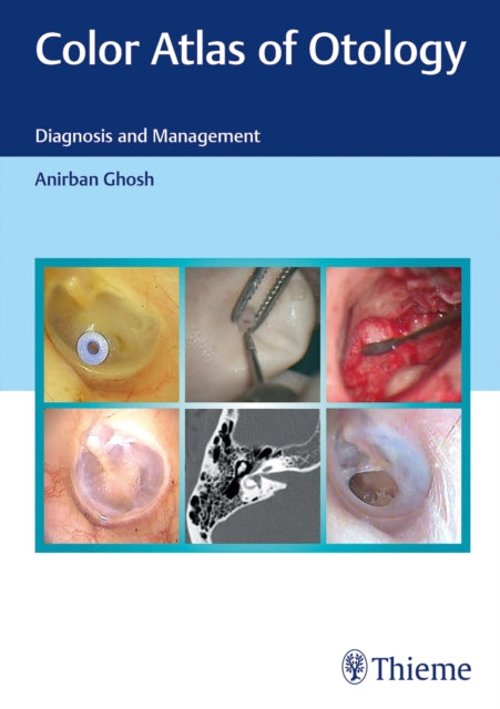 Book cover of: Color Atlas of Otology. By: Anirban Ghosh