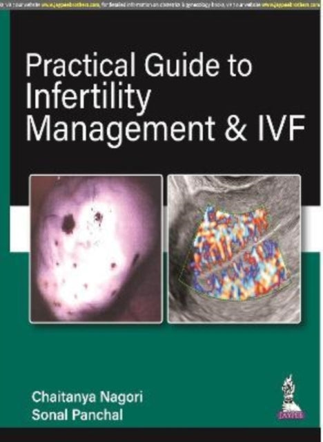 Book cover of: Practical Guide to Infertility Management & IVF. By: Chaitanya Nagori