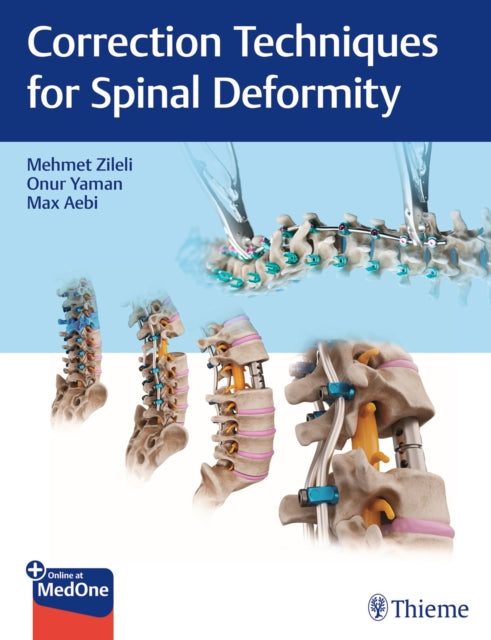 Book cover of: Correction Techniques for Spinal Deformity. By: Mehmet Zileli