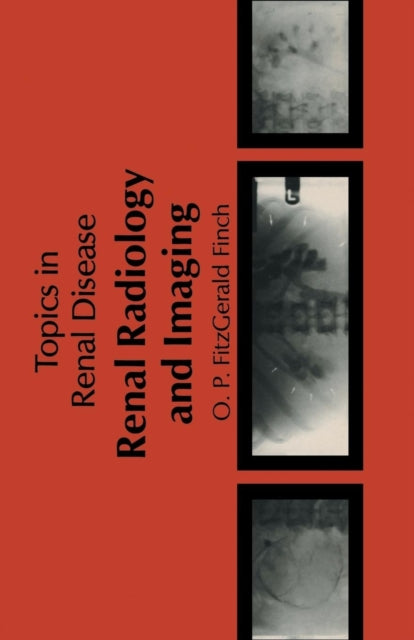 Book cover of: Renal Radiology and Imaging. By: O.P. Fitzgerald-Finch
