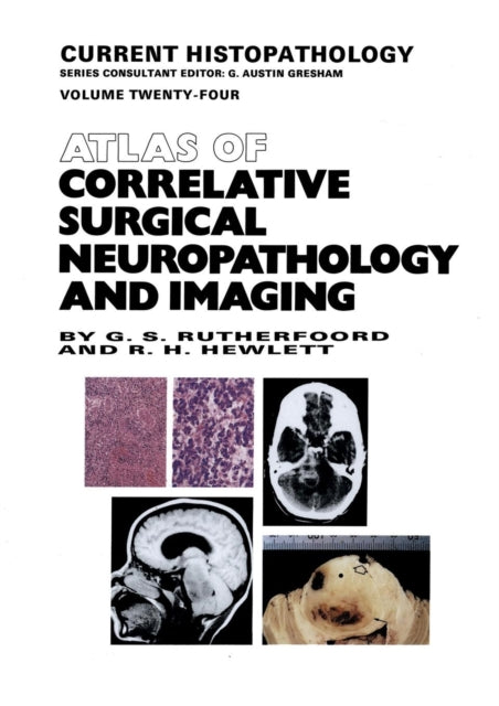 Book cover of: Atlas of Correlative Surgical Neuropathology and Imaging. By: G.S. Rutherfoord