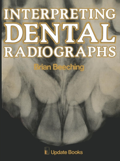 Book cover of: Interpreting Dental Radiographs. By: B.W. Beeching