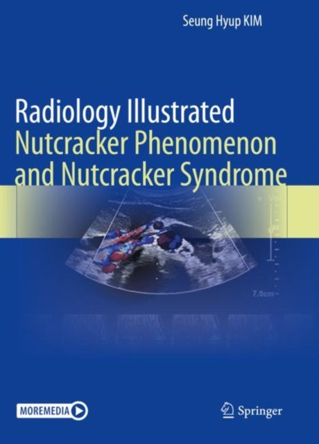 Book cover of: Radiology Illustrated: Nutcracker Phenomenon and Nutcracker Syndrome. By: Seung Hyup Kim