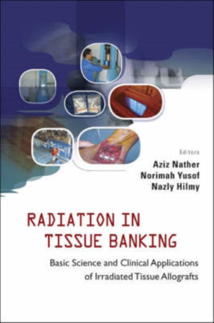 Book cover of: Radiation In Tissue Banking: Basic Science And Clinical Applications Of Irradiated Tissue Allografts