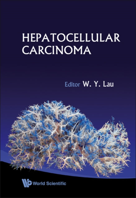 Book cover of: Hepatocellular Carcinoma