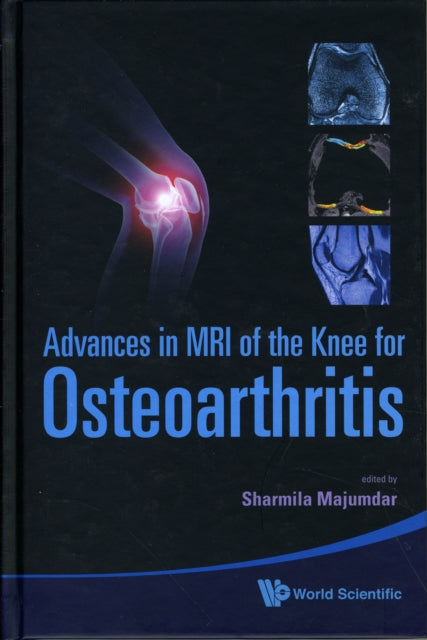 Book cover of: Advances In Mri Of The Knee For Osteoarthritis. By: Sharmila Majumdar