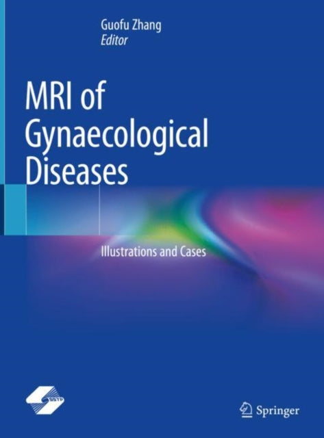 Book cover of: MRI of Gynaecological Diseases. By: Guofu Zhang